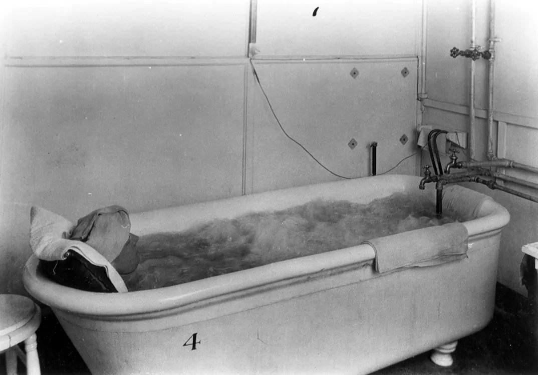 Patient soaking in a whirlpool bath in Battle Creek Sanitarium.